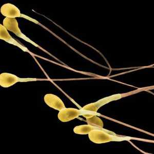 Co je to sperma? Rysy mužské gamet