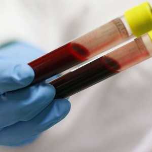 Diagnostiku onemocnění. Biochemický rozbor krve: to ukázat?