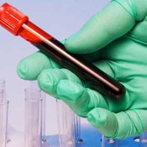 Proč třeba udělat krevní test v onkologii?