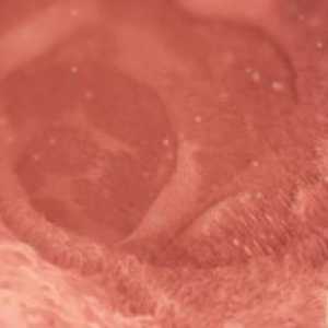 Kde najít odpověď na otázku, co je za den dojde k ovulaci?