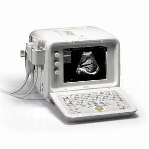 Kde dělat ultrazvuk? Volba nemocnici