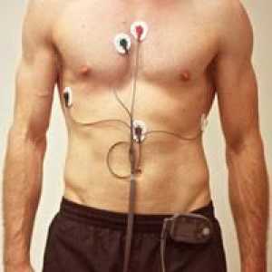 Jaké informace poskytuje denní monitorování srdce?