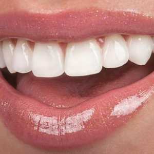 Plastové korunky na přední zuby: indikace, recenze, fotky