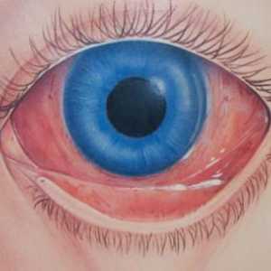 Červené očního bělma: příčiny, následky a léčba. Proč red očního bělma na dítě nebo dospělého?
