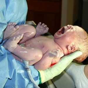 Krvácení do mozku novorozence: příčinách a důsledcích