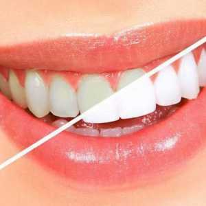 Zuby Vrstvení: popis postupu, komentáře