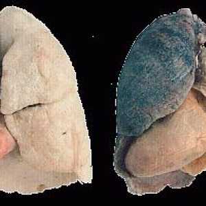 Kuřácké plíce - nejzranitelnější orgánové