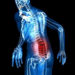 Lumbodynia: co je to? Příčiny, příznaky a léčba bolesti zad