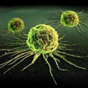 Metody pro detekci nádorových buněk v lidském těle