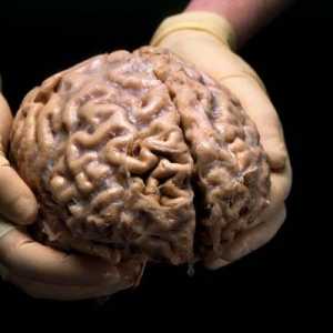 Lidský mozek: Struktura