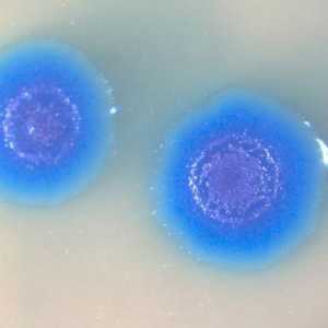 Mycoplasma genitalium: co je to? Jak nebezpečné infekce?