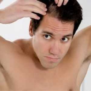 Lidové léky na vypadávání vlasů: recenze mužů a žen