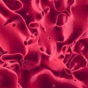 Co může hovořit o krevní sraženiny během menstruace?