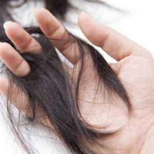 Norma vypadávání vlasů, nebo kolik chlupů denně by měla klesnout?