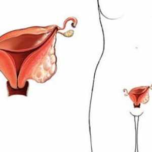 Mezi hlavní příznaky rakoviny dělohy