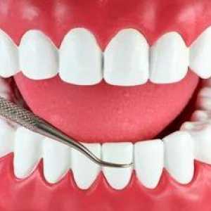 Proč krvácení z dásní a co dělat