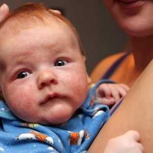 Proč novorozenec hnisat oči?