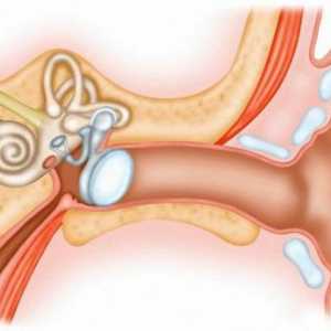 Plug do ucha: příznaky, způsoby, jak odstranit
