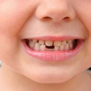 Erupce a růst zubů u dětí: tabulky. All erupce primárních zubů u kojenců