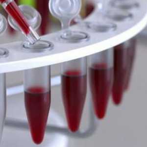 Rozluštění HCT zkušební rychlost v krvi