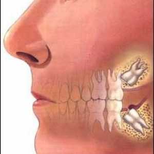 Ovlivnily zub - to je, jak ji léčit?
