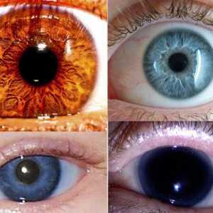 Самый редкий цвет глаз - какой он?