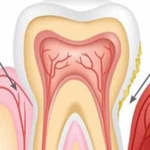 Příznaky periodontální onemocnění, diagnostika a léčba