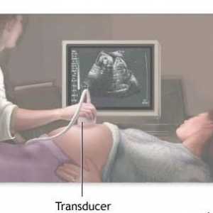 Druhý ultrazvuk během těhotenství o tom, co termín dělat? Uzi během těhotenství, kdy a kolikrát…