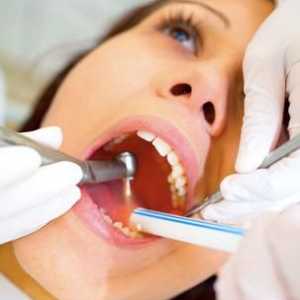 Zub moudrosti léčit nebo odstranit? Extrakce zubu moudrosti